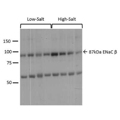 Western Blot epithelial Sodium Channel beta Antibody